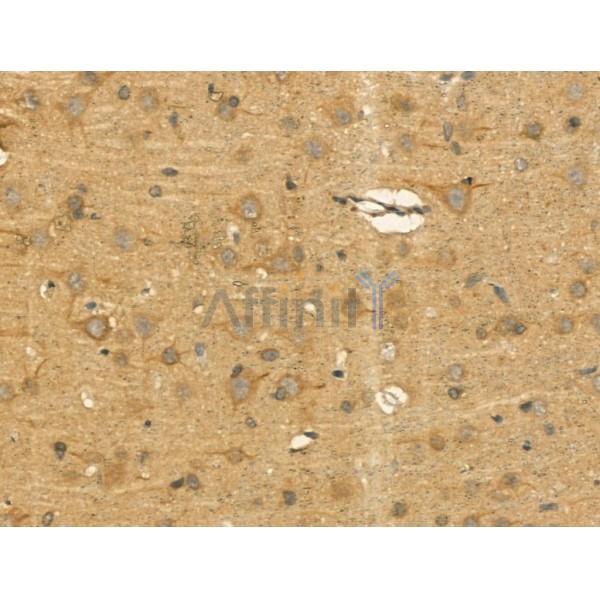 Pericentrin - Centrosome Marker Antibody - DF13210 at 1/100 staining Rat brain tissue by IHC-P.