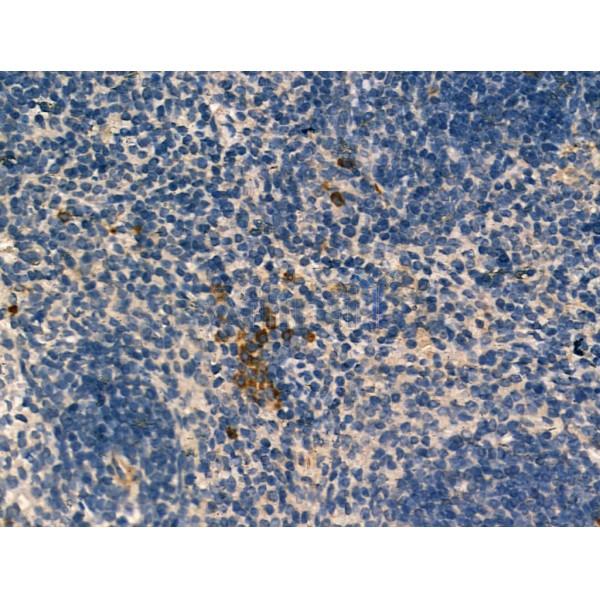 Pericentrin - Centrosome Marker Antibody - DF13210 at 1/100 staining Mouse spleen tissue by IHC-P.