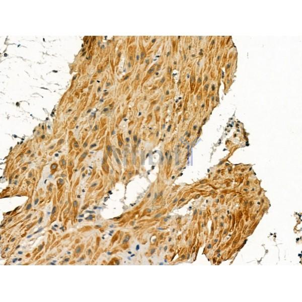 Pericentrin - Centrosome Marker Antibody - DF13210 at 1/100 staining Mouse stomach tissue by IHC-P.