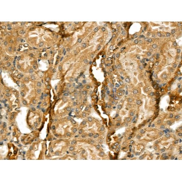 beta COP Antibody - DF13220 at 1/100 staining Rat kidney tissue by IHC-P.