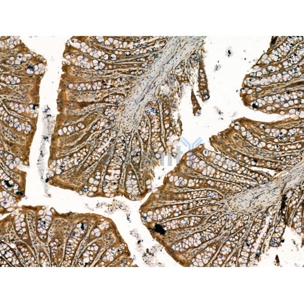 beta COP Antibody - DF13220 at 1/100 staining Rat colorectal tissue by IHC-P.