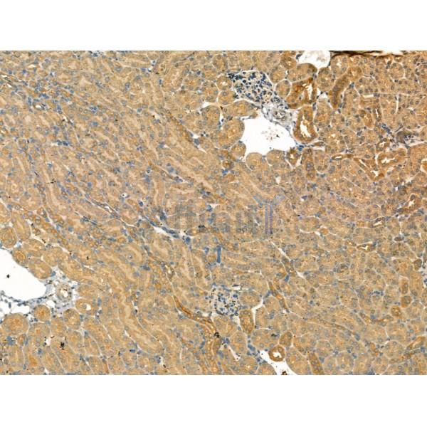 beta COP Antibody - DF13220 at 1/100 staining Mouse kidney tissue by IHC-P.