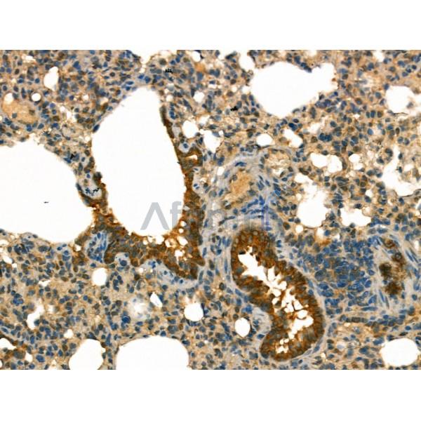 beta COP Antibody - DF13220 at 1/100 staining Rat lung tissue by IHC-P.