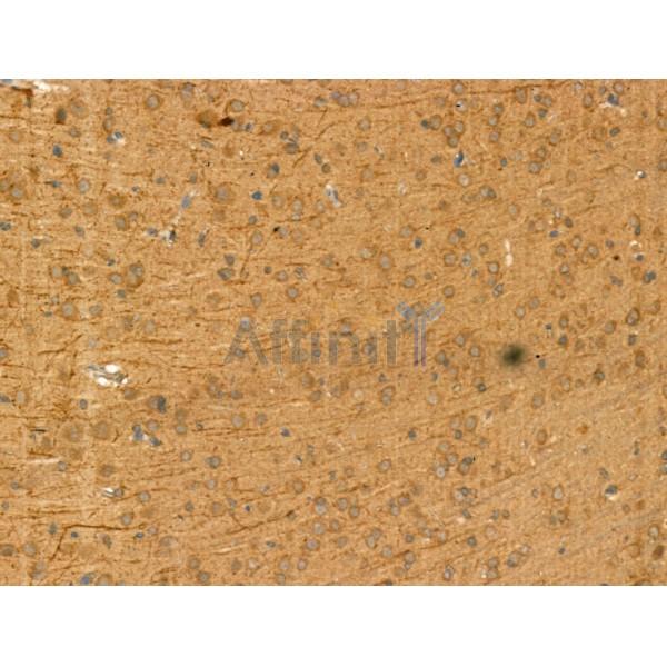 beta COP Antibody - DF13220 at 1/100 staining Rat brain tissue by IHC-P.