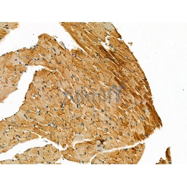 beta COP Antibody - DF13220 at 1/100 staining Mouse heart tissue by IHC-P.