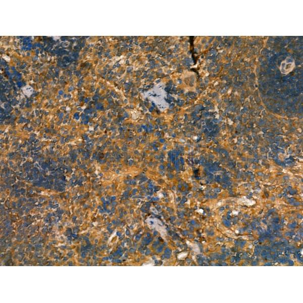 beta COP Antibody - DF13220 at 1/100 staining Rat spleen tissue by IHC-P.