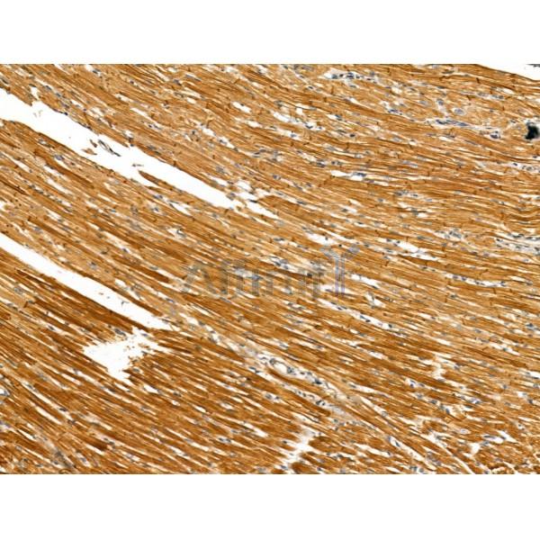 beta COP Antibody - DF13220 at 1/100 staining Rat heart tissue by IHC-P.