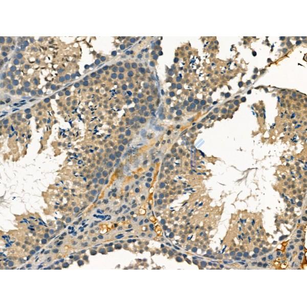 Clathrin heavy chain Antibody - DF13223 at 1/100 staining Mouse testis tissue by IHC-P.