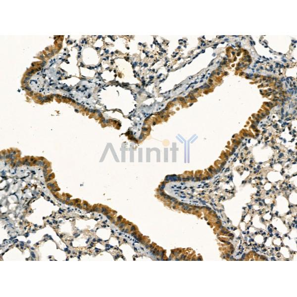 Clathrin heavy chain Antibody - DF13223 at 1/100 staining Mouse lung tissue by IHC-P.
