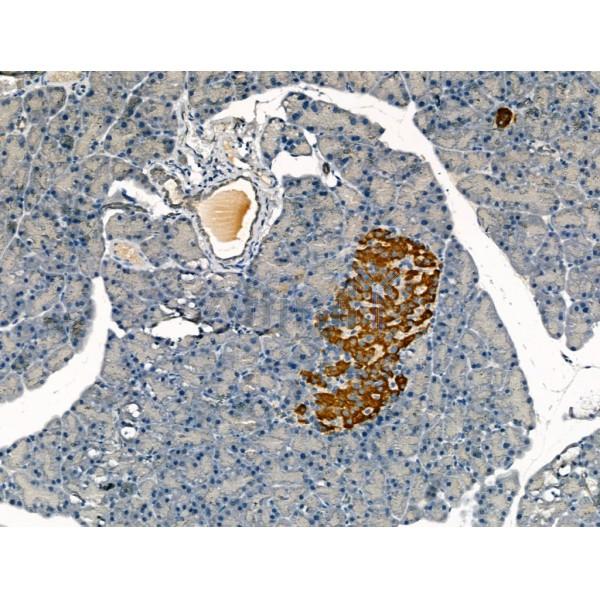 Clathrin heavy chain Antibody - DF13223 at 1/100 staining Rat pancreatic tissue by IHC-P.