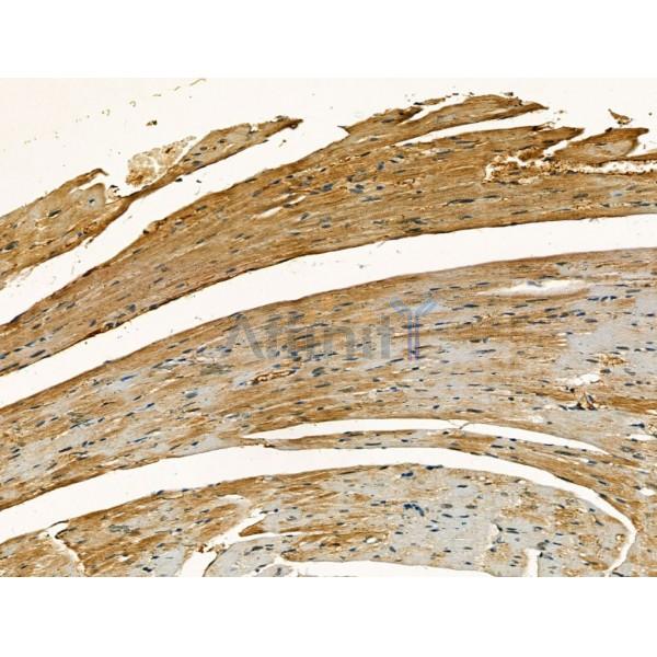 Clathrin heavy chain Antibody - DF13223 at 1/100 staining Mouse heart tissue by IHC-P.