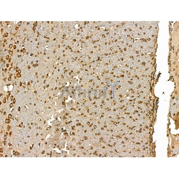 GJB6 Antibody - DF13225 at 1/100 staining Rat brain tissue by IHC-P.