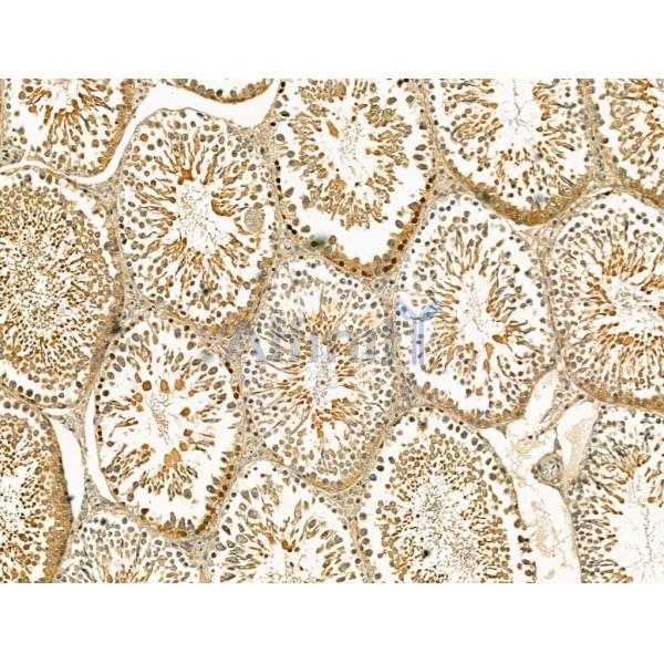 Stra8 Antibody - DF13234 at 1/100 staining Rat testis tissue by IHC-P.