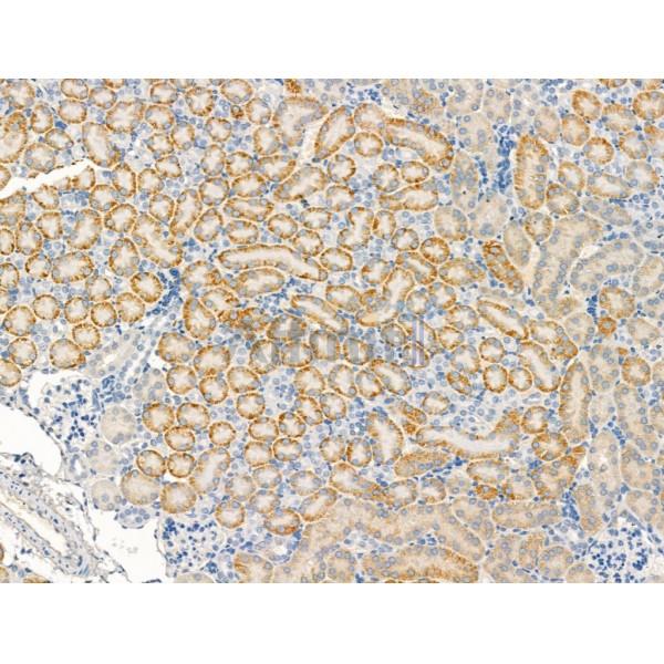 KCNK2 Antibody - DF13242 at 1/100 staining Mouse kidney tissue by IHC-P.