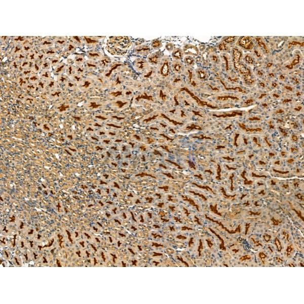 LOX Antibody - DF13251 at 1/100 staining Mouse kidney tissue by IHC-P.