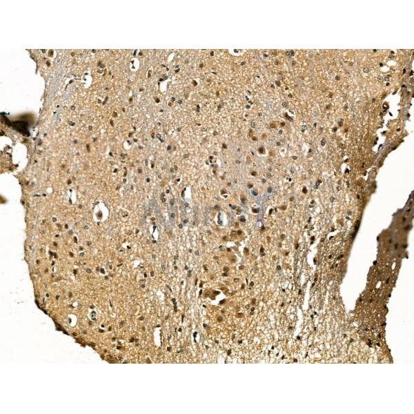 cbx7 Antibody - DF13257 at 1/100 staining Mouse brain tissue by IHC-P.
