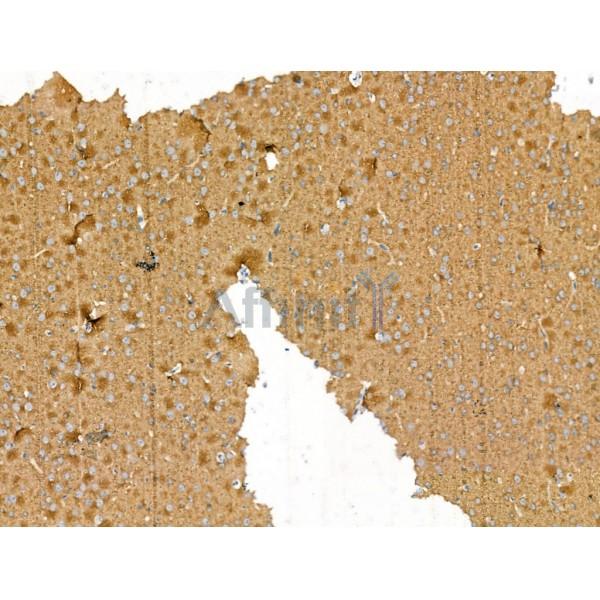 Bassoon Antibody - DF13258 at 1/100 staining Rat brain tissue by IHC-P.