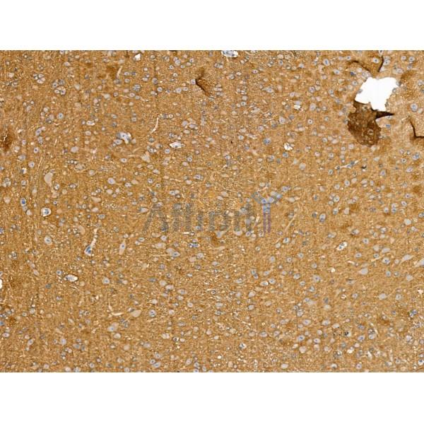 Bassoon Antibody - DF13258 at 1/100 staining Mouse brain tissue by IHC-P.