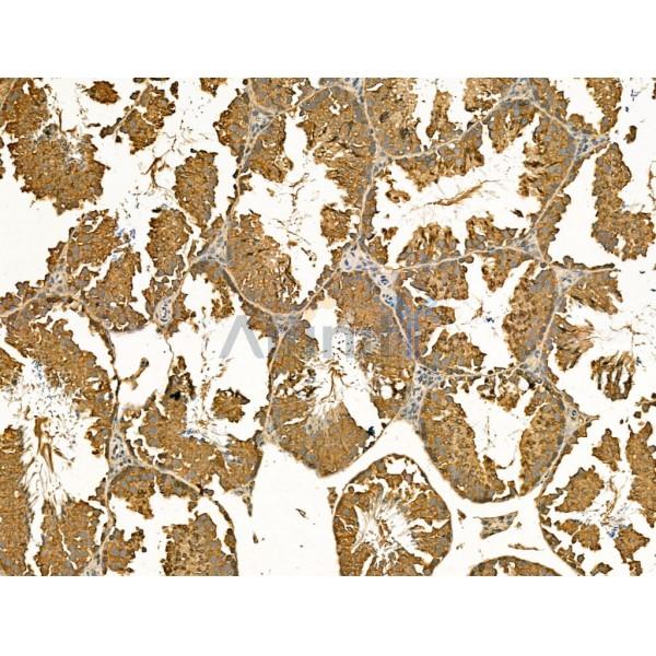 Mannosidase II Antibody - DF13260 at 1/100 staining Mouse testis tissue by IHC-P.