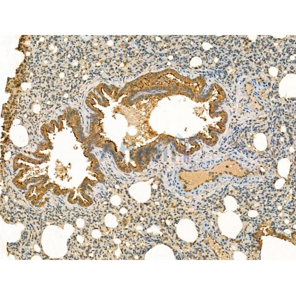 Mannosidase II Antibody - DF13260 at 1/100 staining Rat lung tissue by IHC-P.
