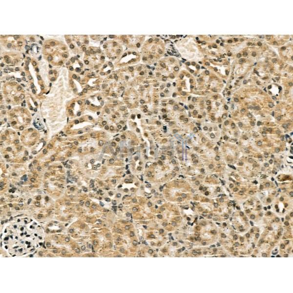 CENPB Antibody - DF13261 at 1/100 staining Mouse kidney tissue by IHC-P.