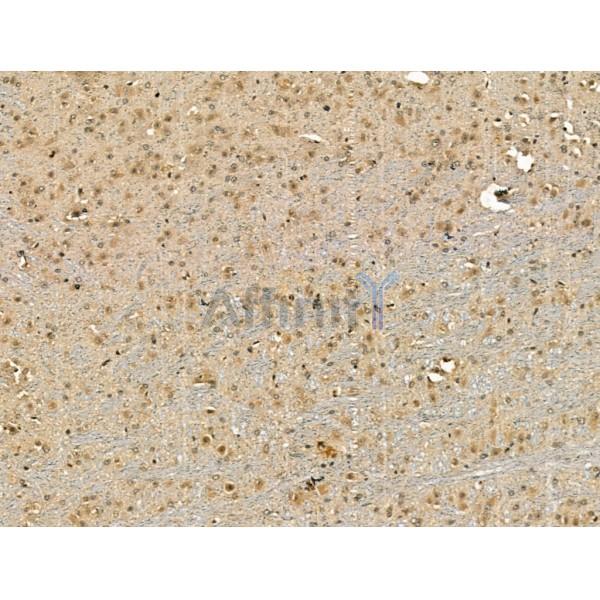 CENPB Antibody - DF13261 at 1/100 staining Mouse brain tissue by IHC-P.