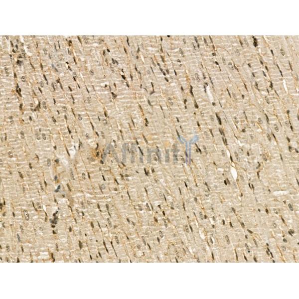 CENPB Antibody - DF13261 at 1/100 staining Rat heart tissue by IHC-P.