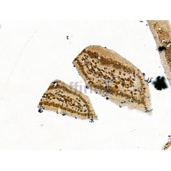 LAP2 alpha Antibody - DF13264 at 1/100 staining Mouse colorectal tissue by IHC-P.