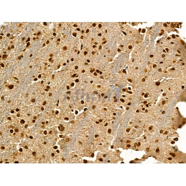 LAP2 alpha Antibody - DF13264 at 1/100 staining Mouse brain tissue by IHC-P.