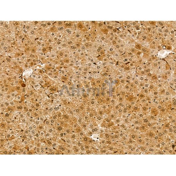 LAP2 alpha Antibody - DF13264 at 1/100 staining Mouse liver tissue by IHC-P.