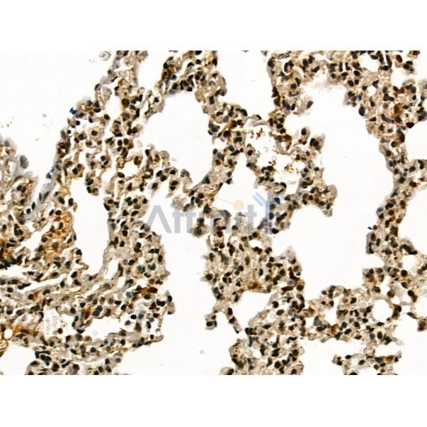 LAP2 alpha Antibody - DF13264 at 1/100 staining Mouse lung tissue by IHC-P.