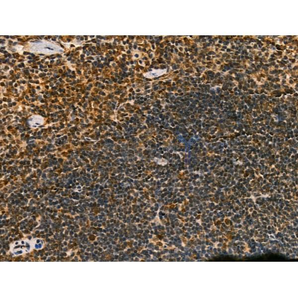 LAP2 alpha Antibody - DF13264 at 1/100 staining Mouse spleen tissue by IHC-P.