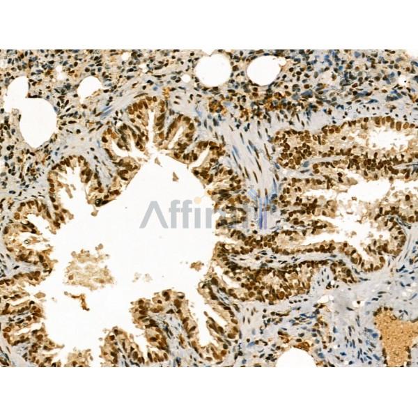 LAP2 alpha Antibody - DF13264 at 1/100 staining Rat lung tissue by IHC-P.