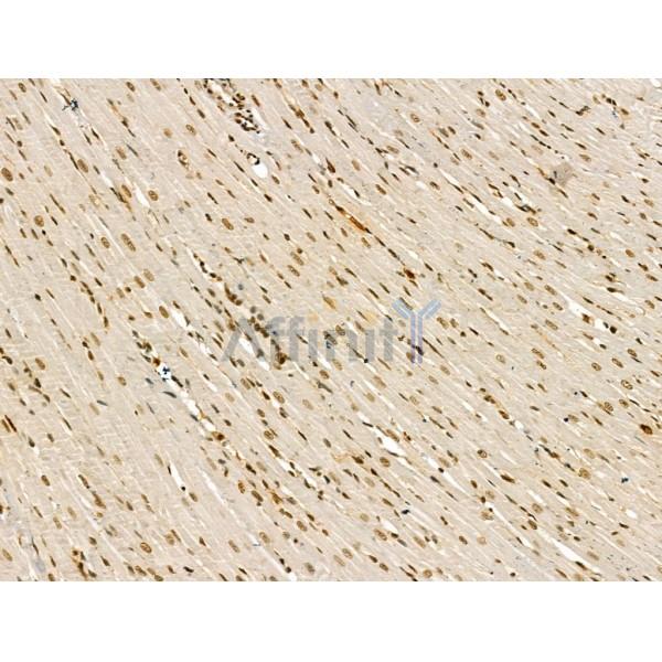 LAP2 alpha Antibody - DF13264 at 1/100 staining Rat heart tissue by IHC-P.