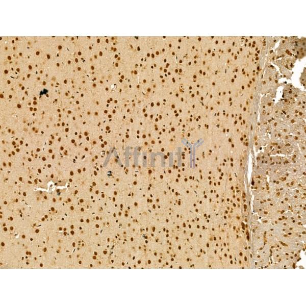 LAP2 alpha Antibody - DF13264 at 1/100 staining Rat brain tissue by IHC-P.