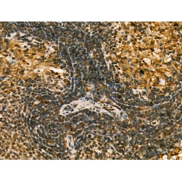 LAP2 alpha Antibody - DF13264 at 1/100 staining Rat spleen tissue by IHC-P.