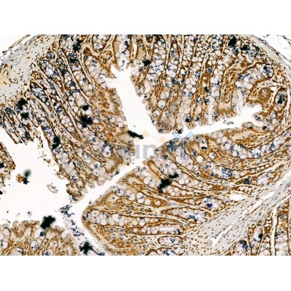 LAP2 alpha Antibody - DF13264 at 1/100 staining Rat colorectal tissue by IHC-P.