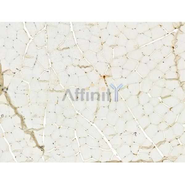 LAP2 alpha Antibody - DF13264 at 1/100 staining Rat muscle tissue by IHC-P.