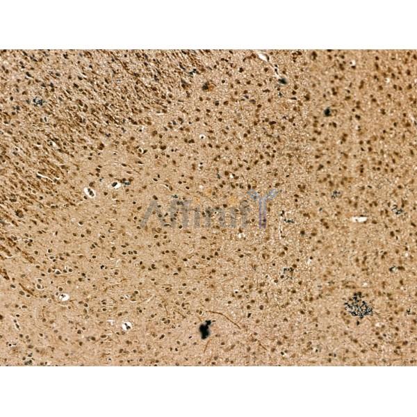 Retinoid X Receptor beta Antibody - DF13265 at 1/100 staining Mouse brain tissue by IHC-P.