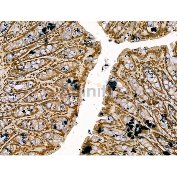 Retinoid X Receptor beta Antibody - DF13265 at 1/100 staining Rat colorectal tissue by IHC-P.