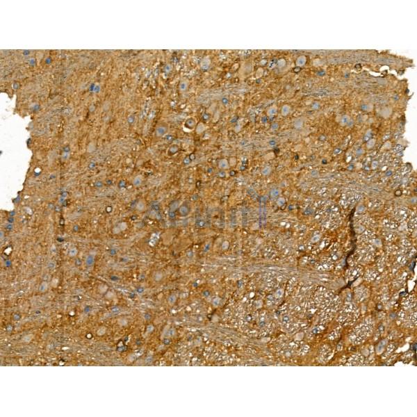 Chromogranin C Antibody - DF13266 at 1/100 staining Mouse brain tissue by IHC-P.