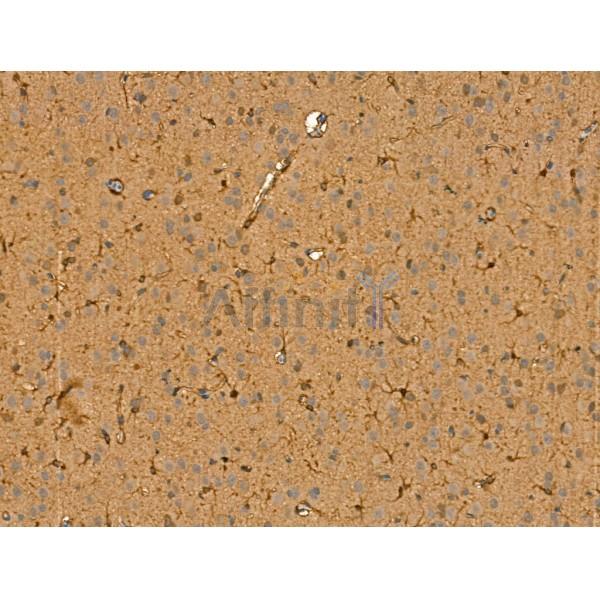 Chromogranin C Antibody - DF13266 at 1/100 staining Rat brain tissue by IHC-P.