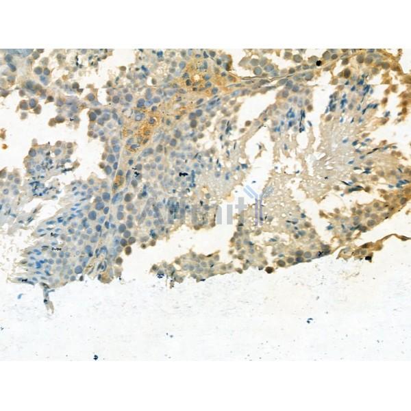 TDP1 Antibody - DF13281 at 1/100 staining Mouse testis tissue by IHC-P.