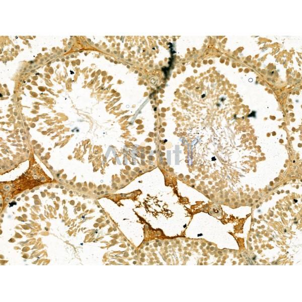 TDP1 Antibody - DF13281 at 1/100 staining Rat testis tissue by IHC-P.