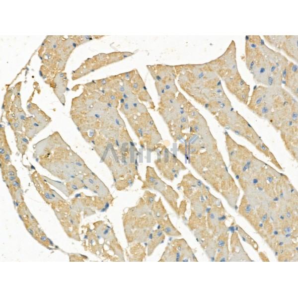 Lgi1 Antibody - DF13285 at 1/100 staining Mouse heart tissue by IHC-P.
