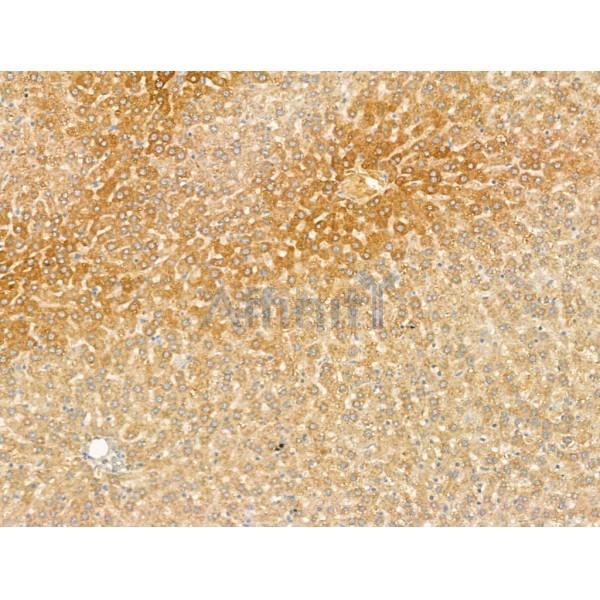 Lgi1 Antibody - DF13285 at 1/100 staining Rat liver tissue by IHC-P.