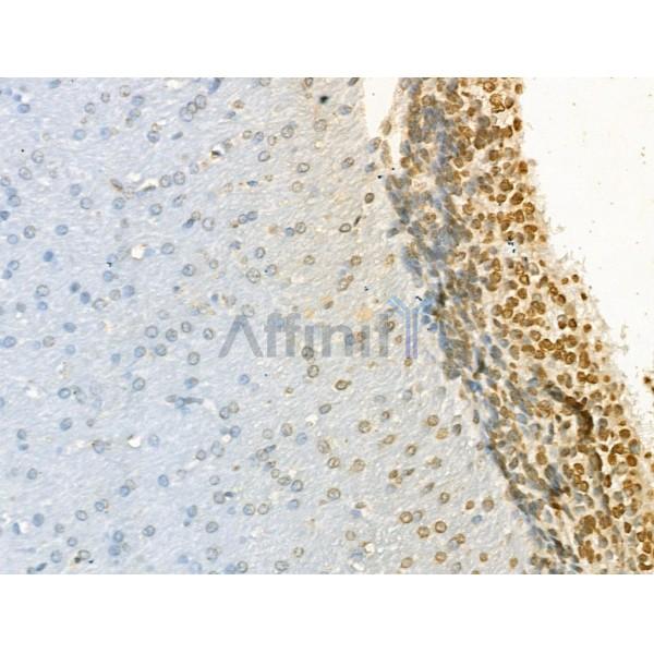 KDM4B / JMJD2B Antibody - DF13288 at 1/100 staining Rat brain tissue by IHC-P.
