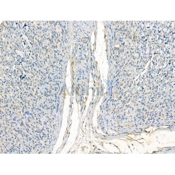 KDM4B / JMJD2B Antibody - DF13288 at 1/100 staining Rat stomach tissue by IHC-P.