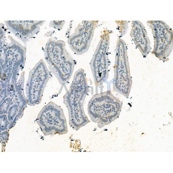 KDM4B / JMJD2B Antibody - DF13288 at 1/100 staining Mouse colorectal tissue by IHC-P.