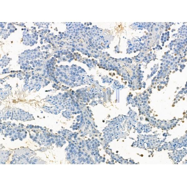 KDM4B / JMJD2B Antibody - DF13288 at 1/100 staining Mouse testis tissue by IHC-P.